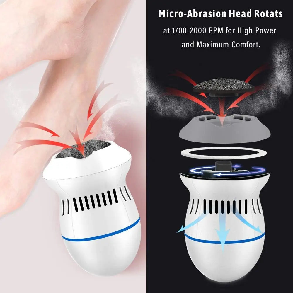 Rectificadora eléctrica de pies, cortadora de rotura de piel muerta, herramientas de molienda, eliminador de callos de pedicura