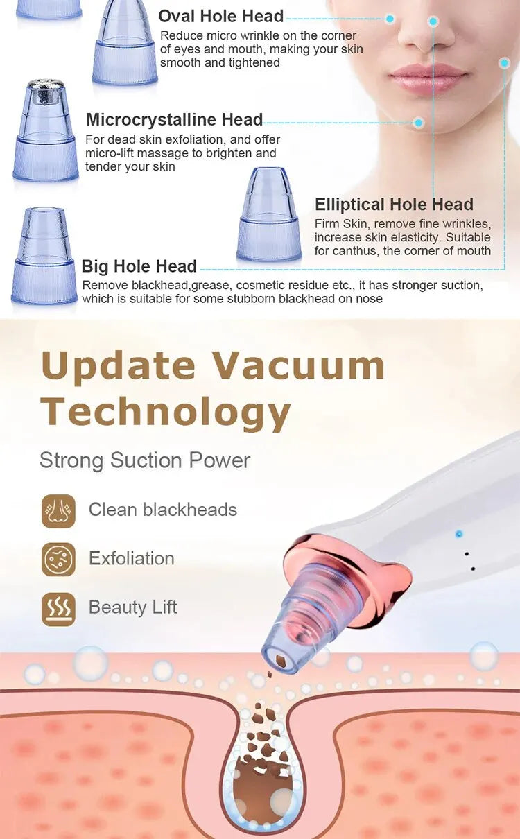 Blackhead Suction Instrument Remove Dead Skin Cells and Impurities - Cosmetic Face Acne Blackhead Cleanser