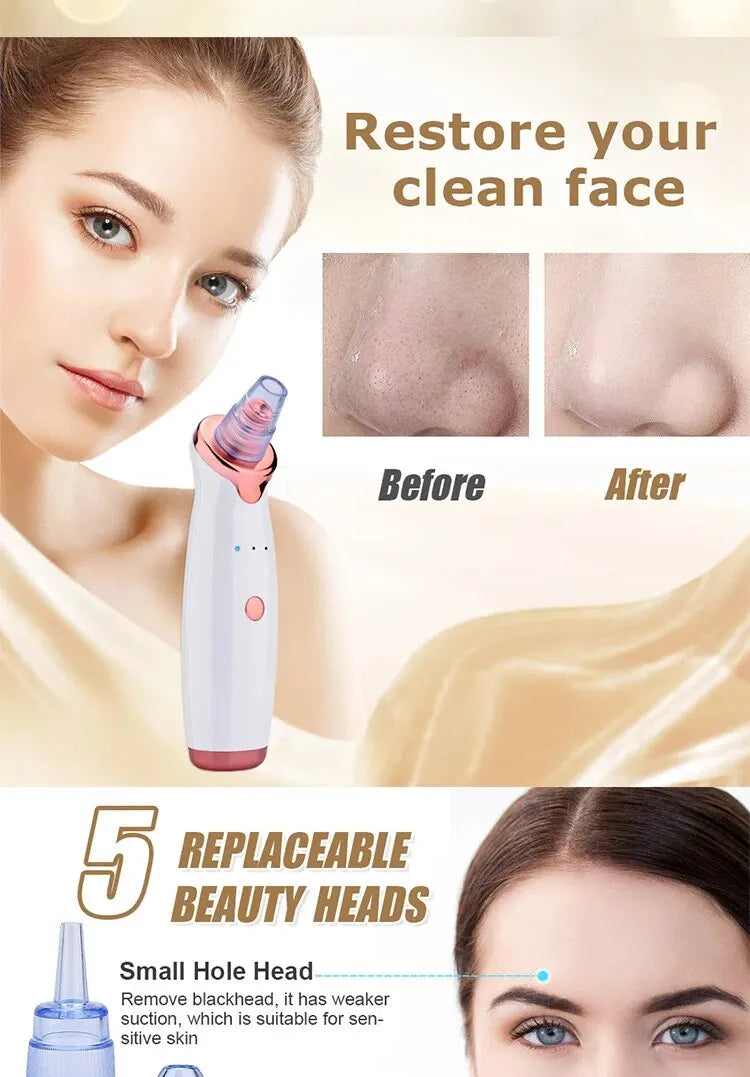 Blackhead Suction Instrument Remove Dead Skin Cells and Impurities - Cosmetic Face Acne Blackhead Cleanser