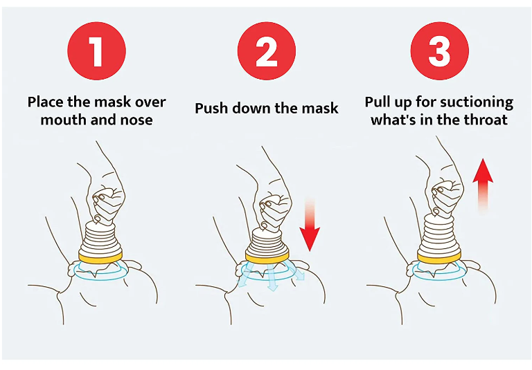 AntiChoke  Device First Aid Choking Relief